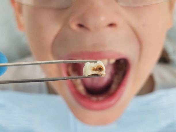 Best Emergency Cosmetic Dentistry in Shanor Northvue, PA